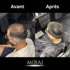 Miraj Men Hair Concealer