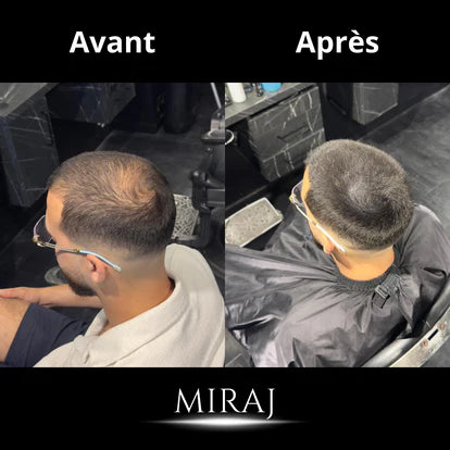 Miraj Men Hair Concealer